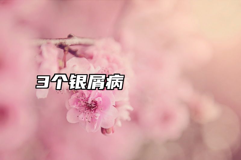3个银屑病
